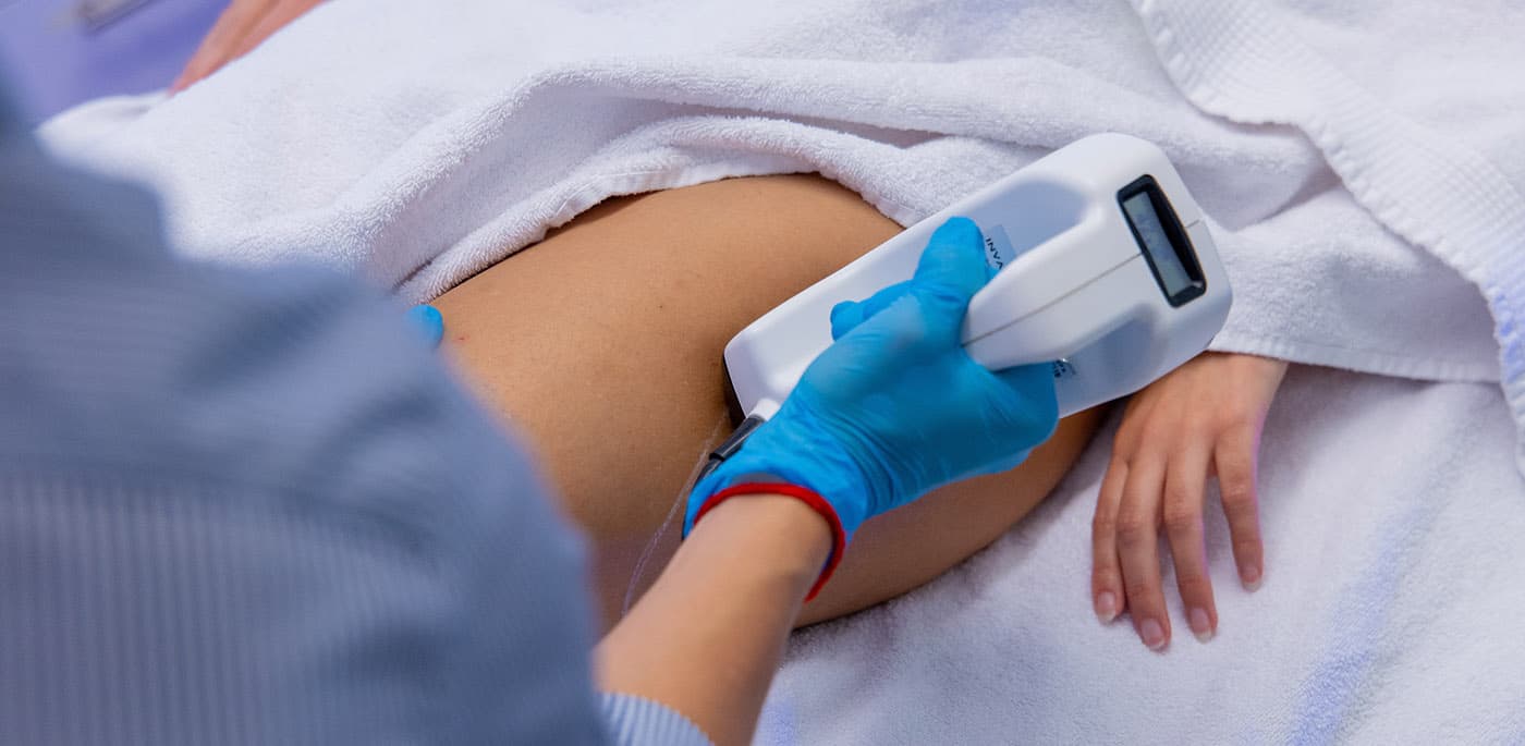 Professionelle Laser-Haarentfernung mit modernem Diodenlaser bei Lira Kosmetik